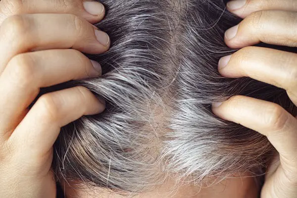 1649958874 676 How to Dye Gray Hair Naturally – These 7 home - How to Dye Gray Hair Naturally?  – These 7 home remedies will help you!